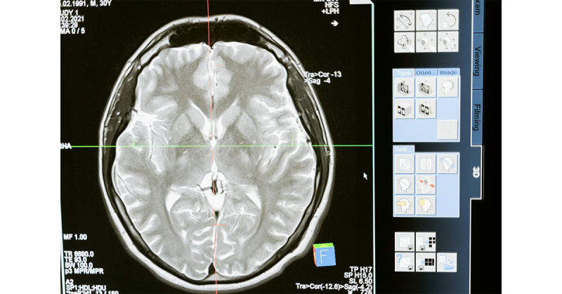 Wybór Neurologa - Jakiego Specjalistę Wybrać?